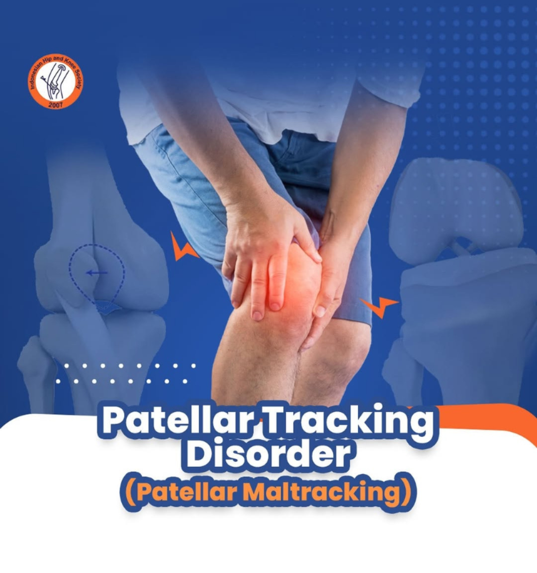 Patellar Tracking Disorder (Patellar Maltracking)