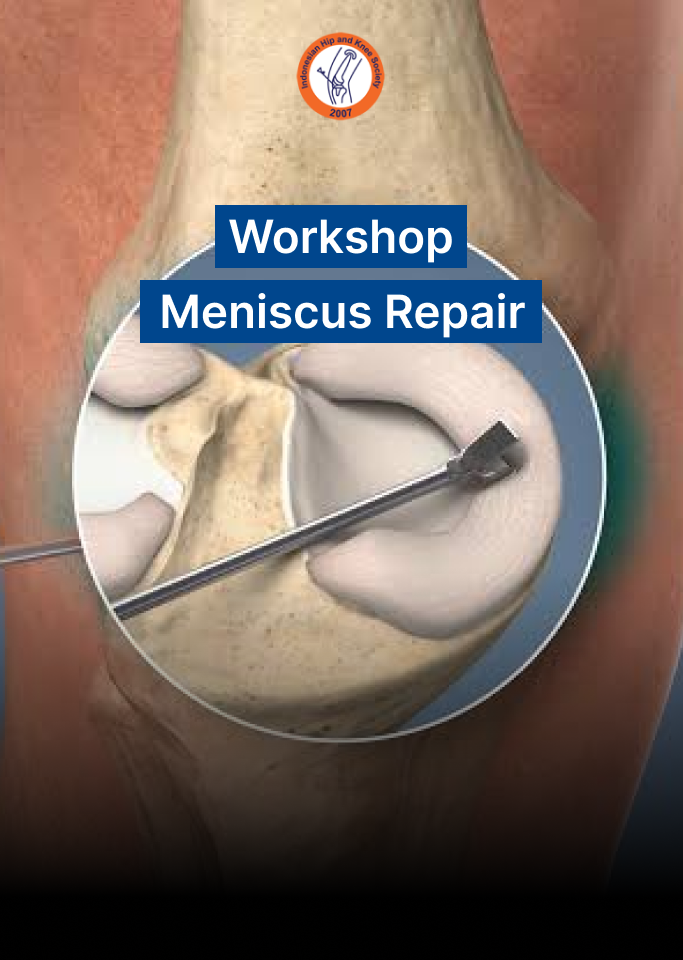 Workshop Meniscus Repair